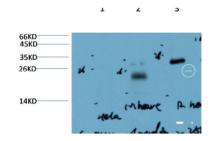 Claudin-2 (8H11) Mouse mAb | EM1403