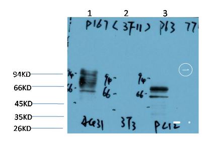 P63-α (3F11) Mouse mAb | EM1404