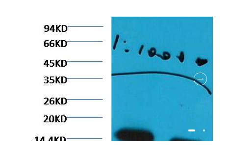 Histone H3(di methyl K27) Monoclonal antibody | EM1101