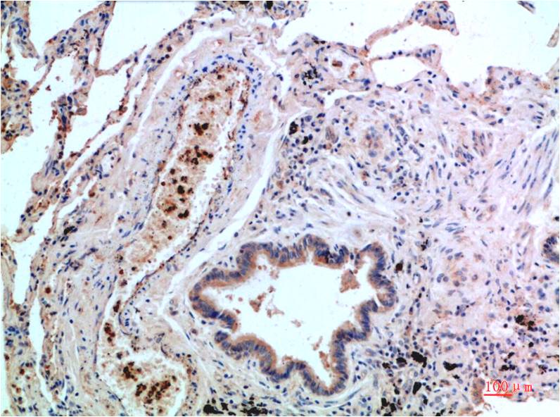 P38 (1G1) Mouse mAb | EM1369