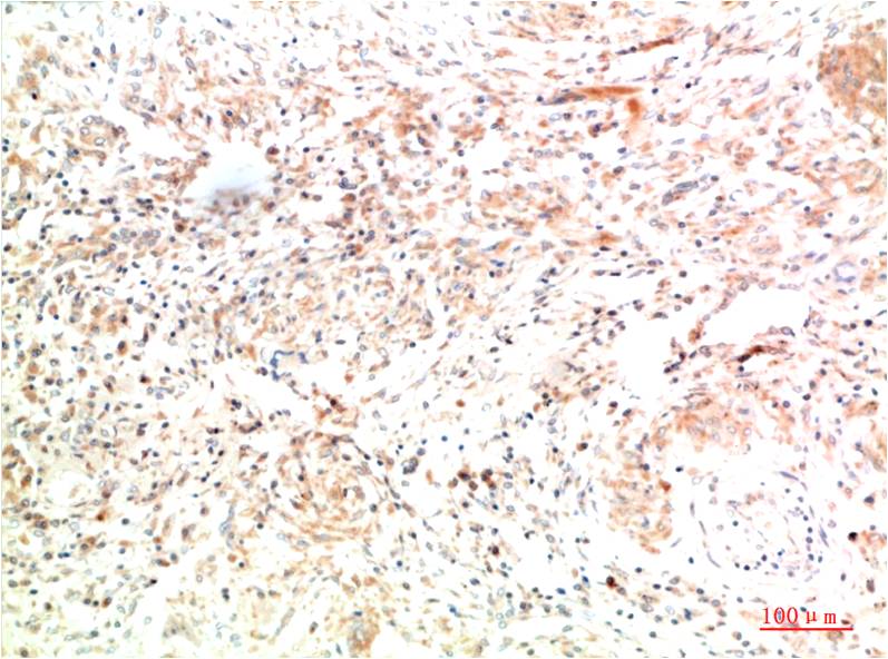 Collagen II (8F6) Mouse mAb | EM1372