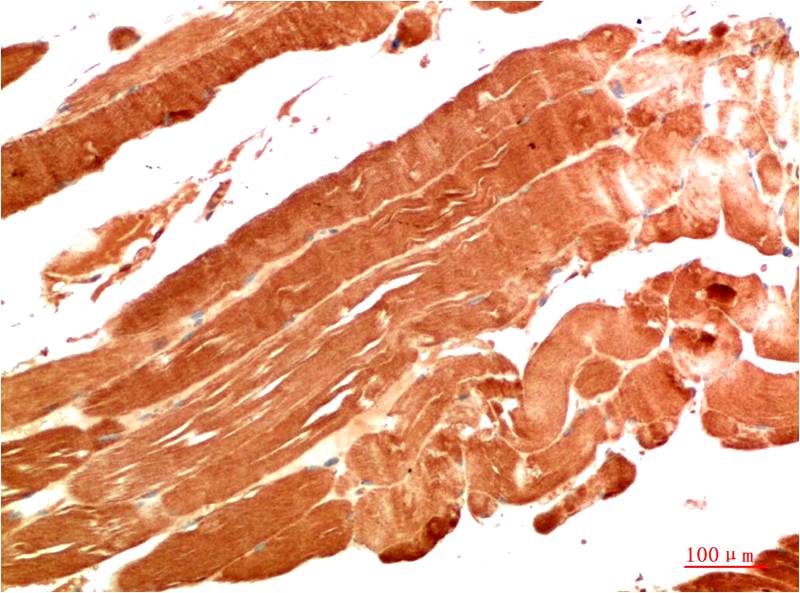 NBR1 (7C3) Mouse mAb | EM1373