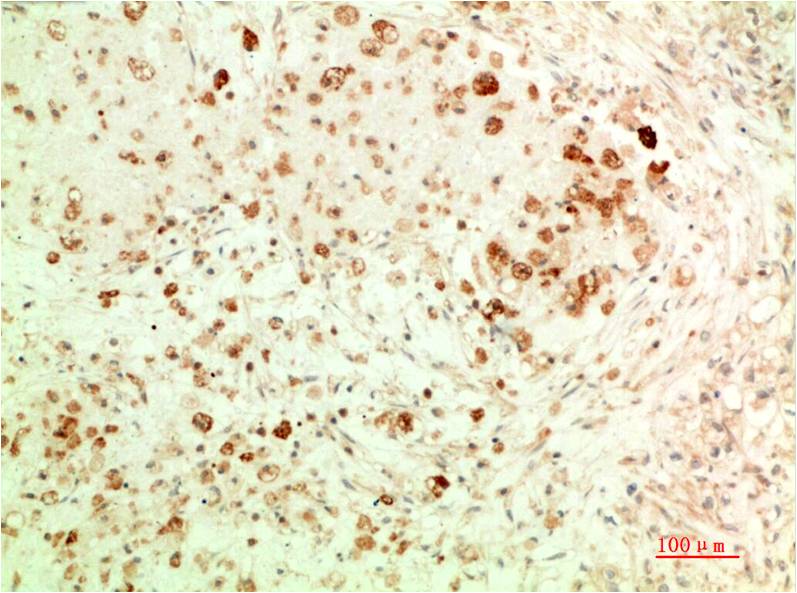 ATG5 (3C7) Mouse mAb | EM1374