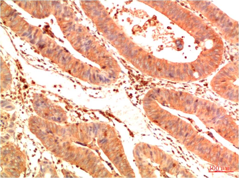 Acetyl P53(K382) (1G7) Mouse mAb | EM1382