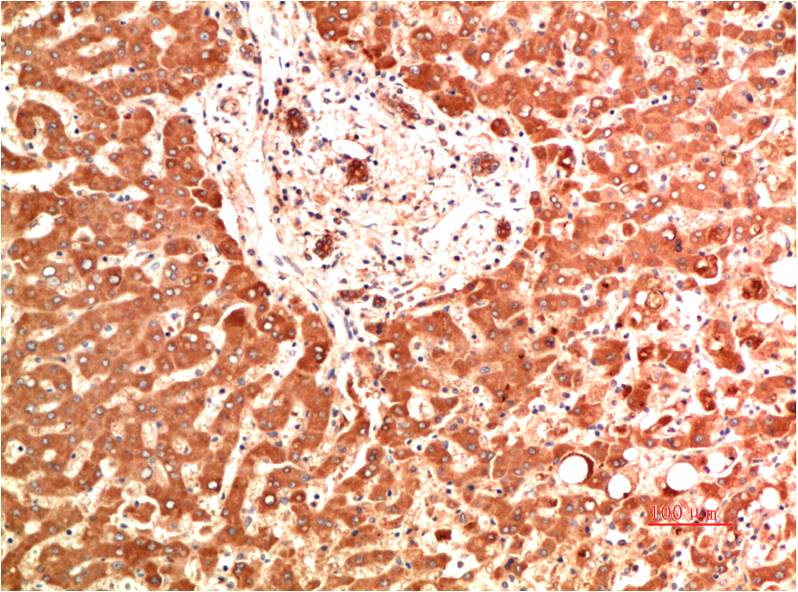 Collagen IV (5C9) Mouse mAb | EM1393